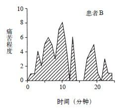 图15续：峰终与过程忽视的对照——A过程短但结尾疼、B过程长但结尾轻，回顾性评分由峰值与结尾决定，与总时长无关